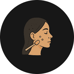 Mole, Skin Tag & Wart Removal in Hyderabad | Safe Removal, Scarring & Cost