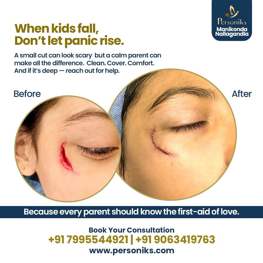 Child Cut Injuries First Aid – A Complete Safety Guide for Parents
