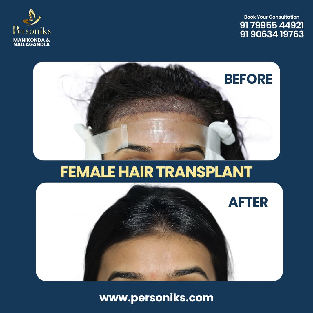 Additional Procedure Results