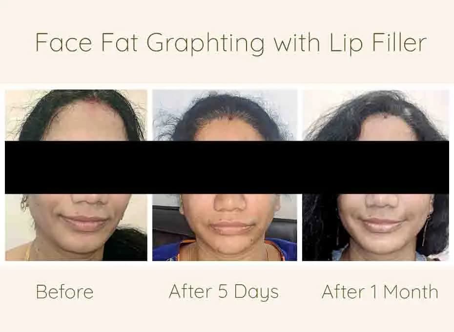 Before and After Results 1