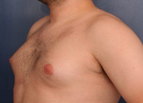 Before and After Results 2